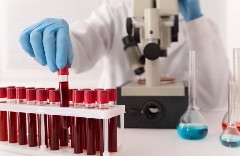 Lee más sobre el artículo Pacientes oncológicos con anemia requieren donación de sangre