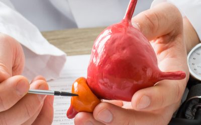 El cáncer de próstata es la primera causa de muerte entre los hombres venezolanos